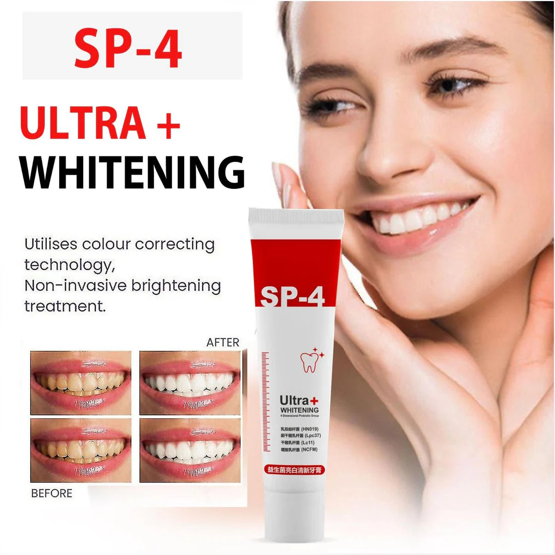 SP-4 Ultra+ Whitening Teeth (Pack of 1)
