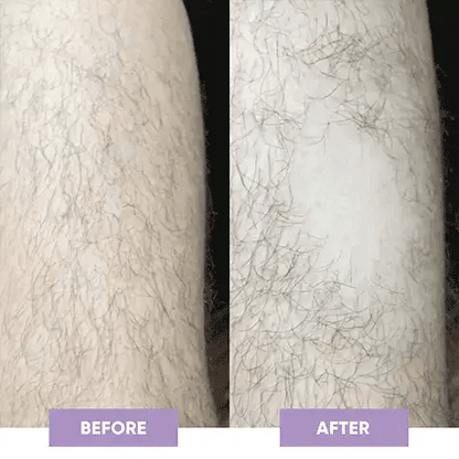 Painless Facial Body Hair Trimmer