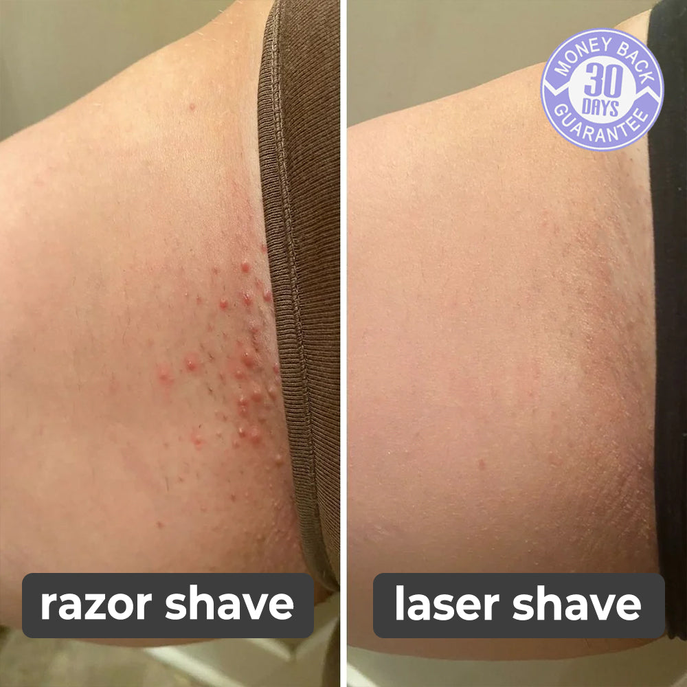 Painless Facial Body Hair Trimmer