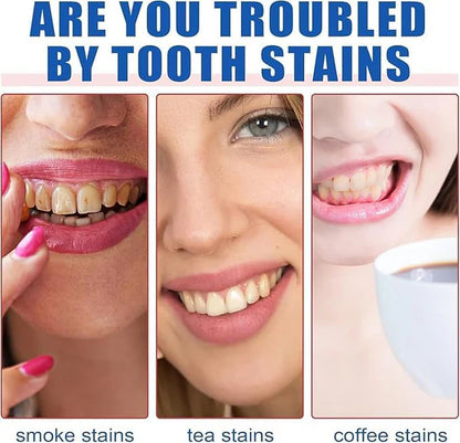 SP-4 Ultra+ Whitening Teeth (Pack of 1)