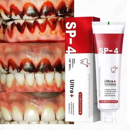SP-4 Ultra+ Whitening Teeth (Pack of 1)